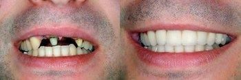 A recent implants dentist job in the  area